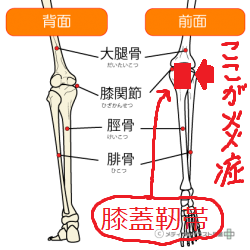 膝蓋靭帯