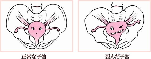 子宮の状態